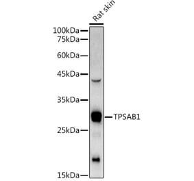 Western Blot - Anti-Mast Cell Tryptase Antibody (A13816) - Antibodies.com