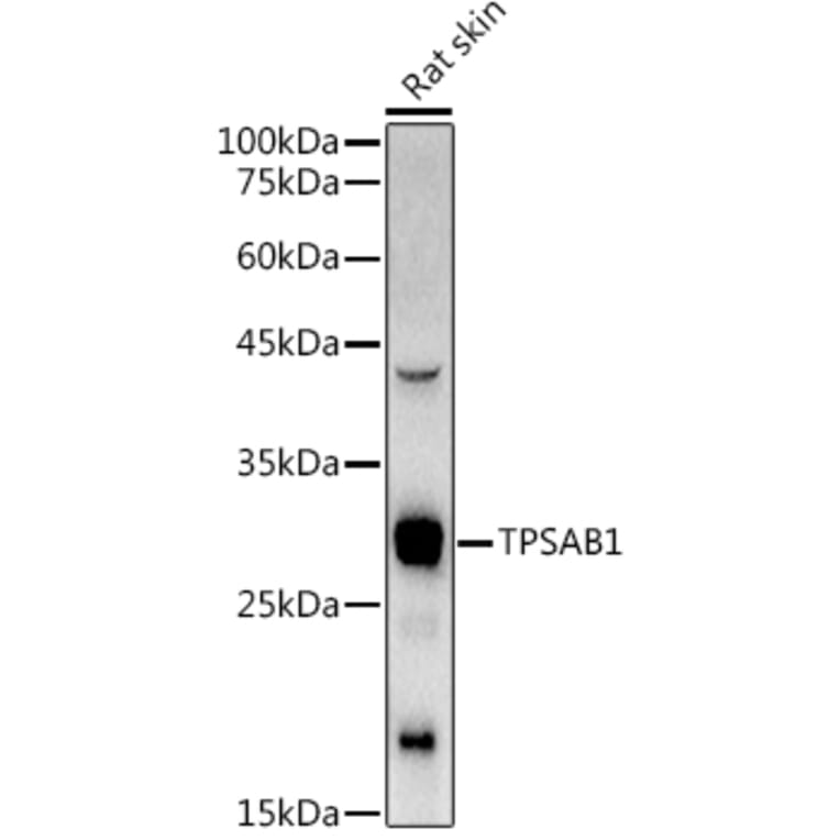 anti-mast-cell-tryptase-antibody-a13816-antibodies