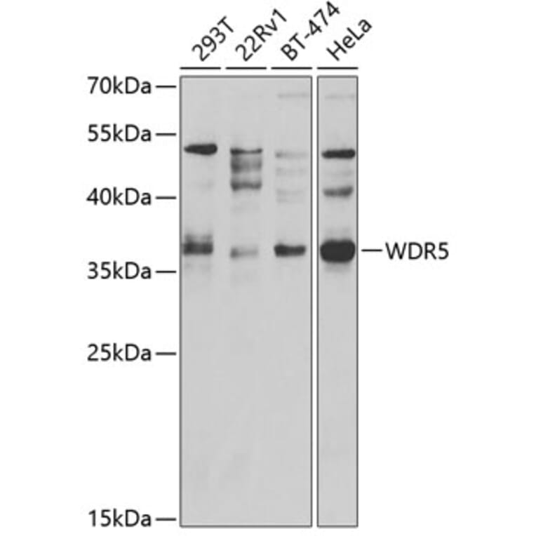 Western Blot - Anti-WDR5 Antibody (A2023) - Antibodies.com