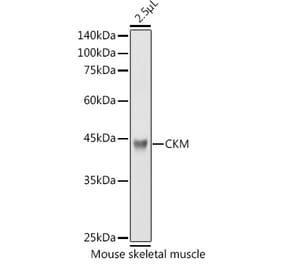 Western Blot - Anti-Creatine Kinase MM Antibody (A13818) - Antibodies.com