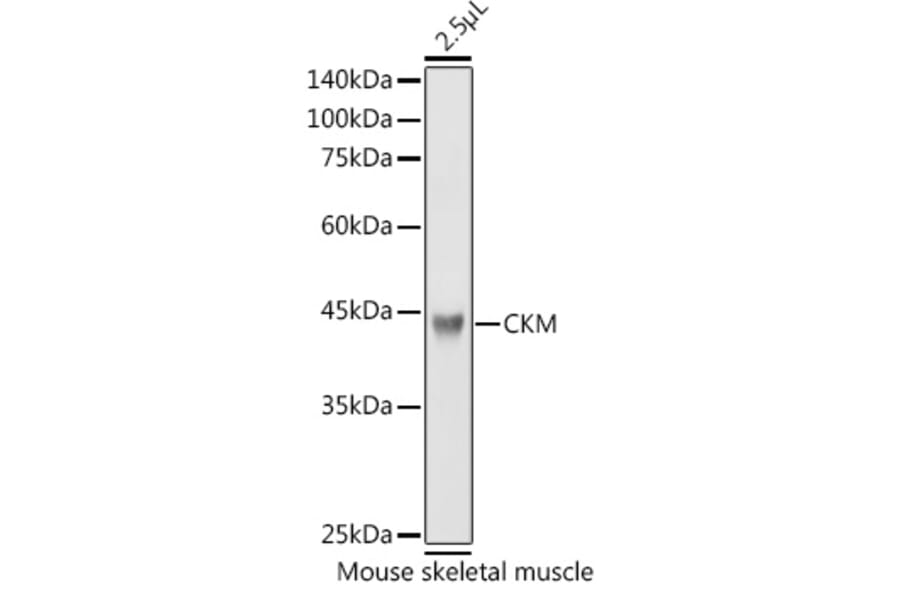 Western Blot - Anti-Creatine Kinase MM Antibody (A13818) - Antibodies.com