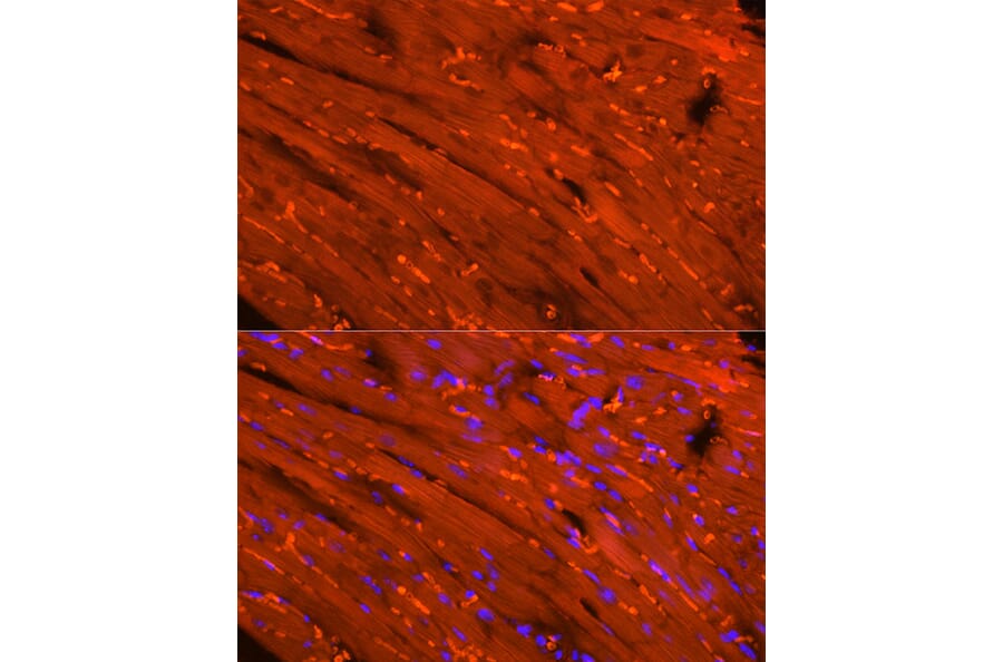 Immunofluorescence - Anti-Creatine Kinase MM Antibody (A13818) - Antibodies.com