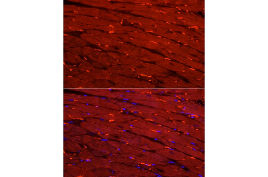 Immunofluorescence - Anti-Creatine Kinase MM Antibody (A13818) - Antibodies.com