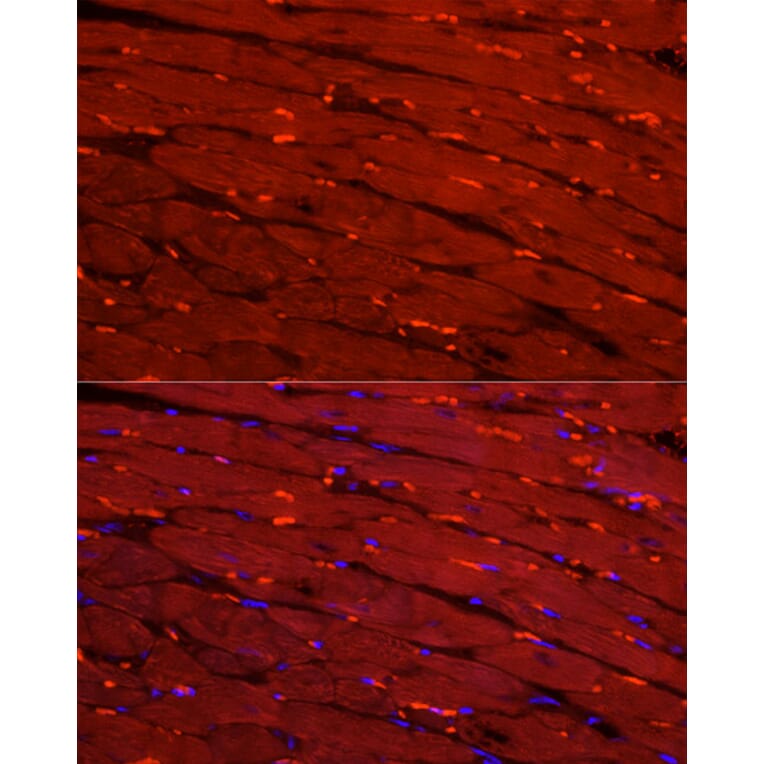 Immunofluorescence - Anti-Creatine Kinase MM Antibody (A13818) - Antibodies.com