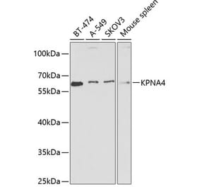 Western Blot - Anti-KPNA4 Antibody (A13819) - Antibodies.com