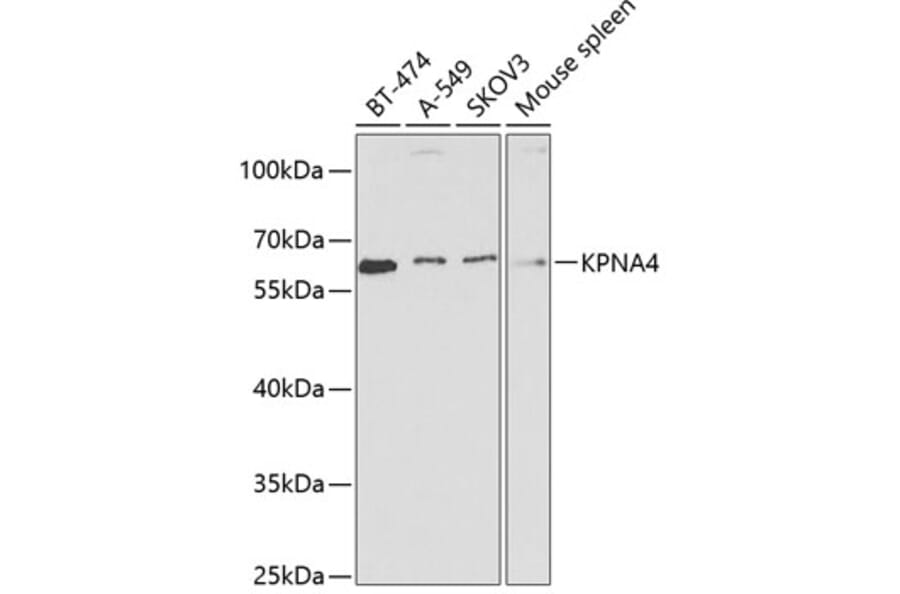 Western Blot - Anti-KPNA4 Antibody (A13819) - Antibodies.com