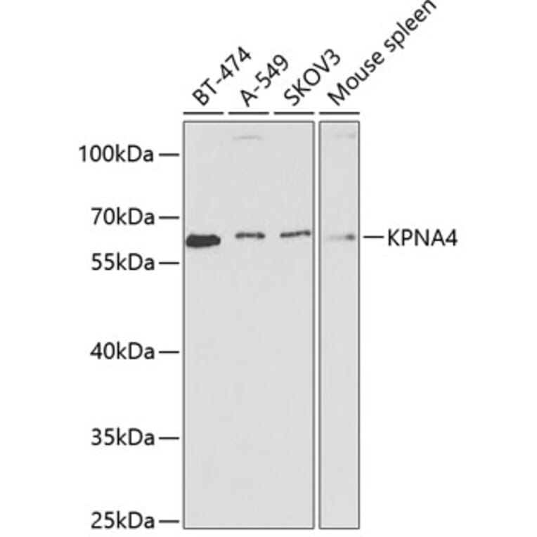 Western Blot - Anti-KPNA4 Antibody (A13819) - Antibodies.com