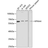 Western Blot - Anti-KPNA4 Antibody (A13819) - Antibodies.com