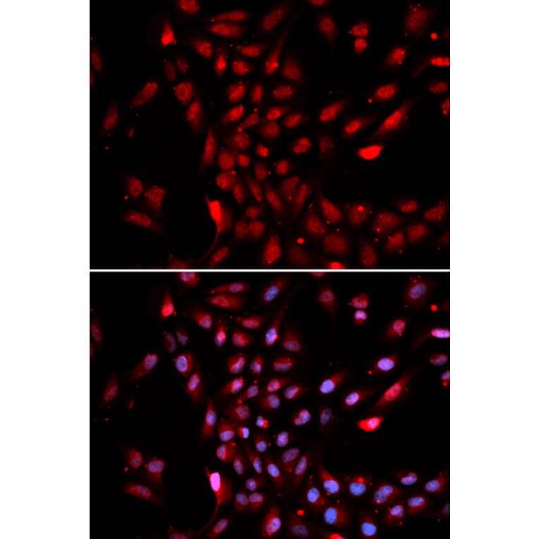 Immunofluorescence - Anti-KPNA4 Antibody (A13819) - Antibodies.com