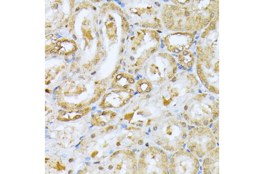 Immunohistochemistry - Anti-Ubiquitin Antibody (A13820) - Antibodies.com