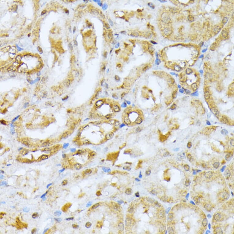 Immunohistochemistry - Anti-Ubiquitin Antibody (A13820) - Antibodies.com