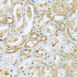 Immunohistochemistry - Anti-Ubiquitin Antibody (A13820) - Antibodies.com