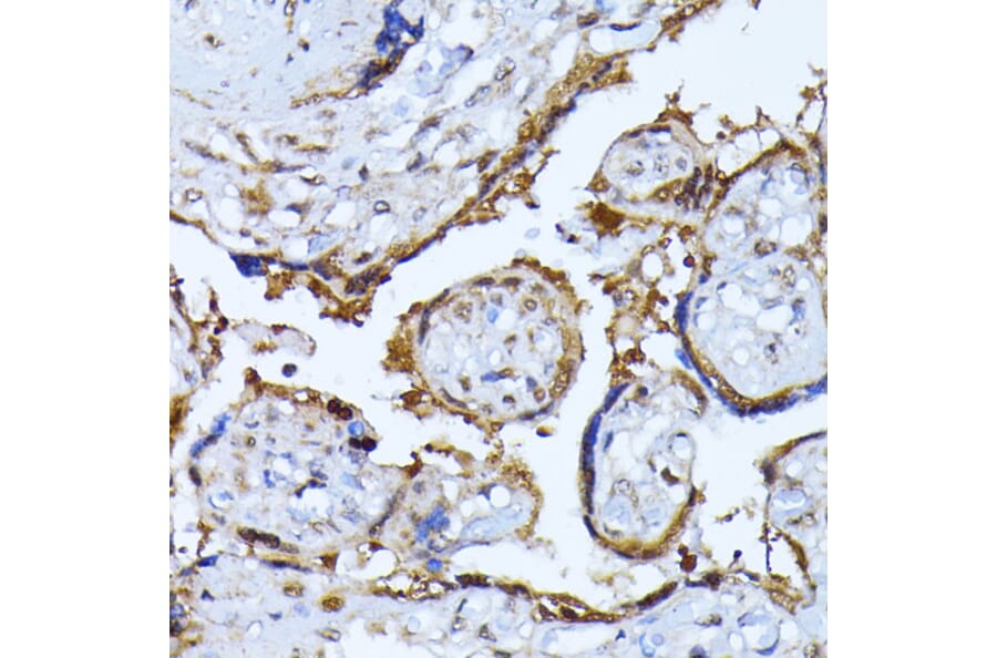 Immunohistochemistry - Anti-Ubiquitin Antibody (A13820) - Antibodies.com
