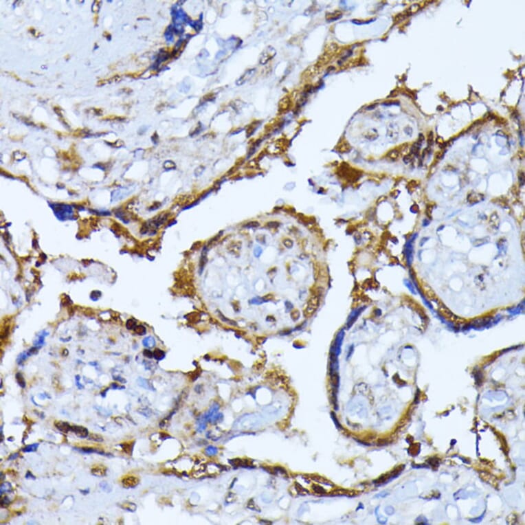 Immunohistochemistry - Anti-Ubiquitin Antibody (A13820) - Antibodies.com