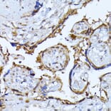 Immunohistochemistry - Anti-Ubiquitin Antibody (A13820) - Antibodies.com