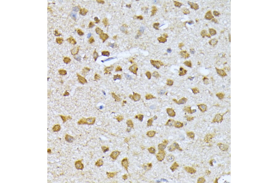 Immunohistochemistry - Anti-Ubiquitin Antibody (A13820) - Antibodies.com