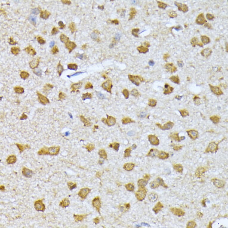 Immunohistochemistry - Anti-Ubiquitin Antibody (A13820) - Antibodies.com