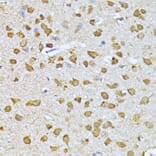 Immunohistochemistry - Anti-Ubiquitin Antibody (A13820) - Antibodies.com