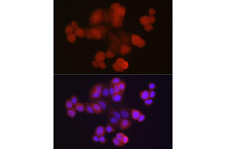 Immunofluorescence - Anti-Ubiquitin Antibody (A13820) - Antibodies.com
