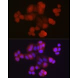 Immunofluorescence - Anti-Ubiquitin Antibody (A13820) - Antibodies.com