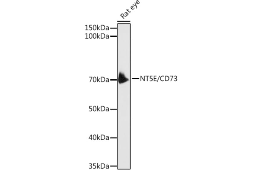 Western Blot - Anti-CD73 Antibody (A13821) - Antibodies.com