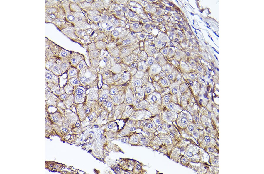 Immunohistochemistry - Anti-CD73 Antibody (A13821) - Antibodies.com