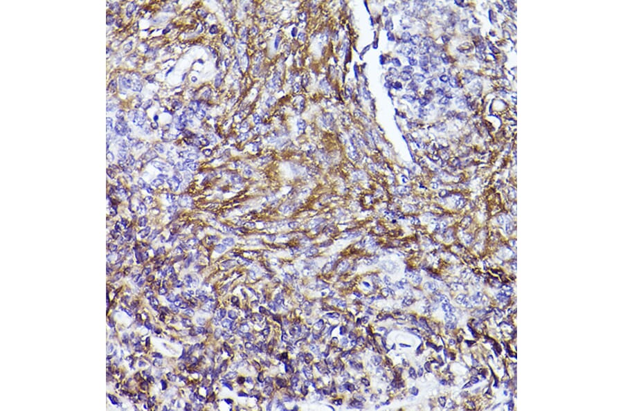 Immunohistochemistry - Anti-CD73 Antibody (A13821) - Antibodies.com