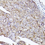 Immunohistochemistry - Anti-CD73 Antibody (A13821) - Antibodies.com