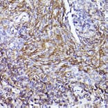 Immunohistochemistry - Anti-CD73 Antibody (A13821) - Antibodies.com