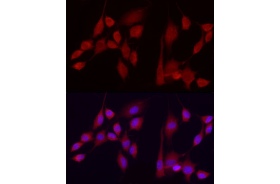 Immunofluorescence - Anti-Ext1 Antibody (A13822) - Antibodies.com