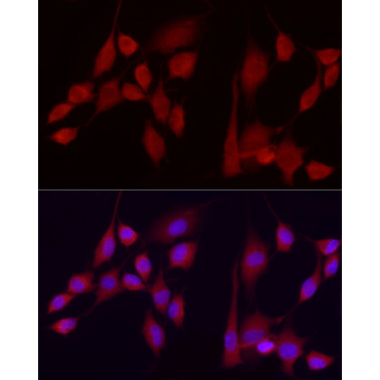 Immunofluorescence - Anti-Ext1 Antibody (A13822) - Antibodies.com