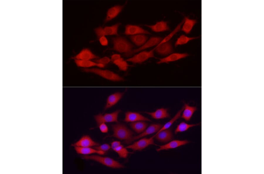 Immunofluorescence - Anti-Ext1 Antibody (A13822) - Antibodies.com