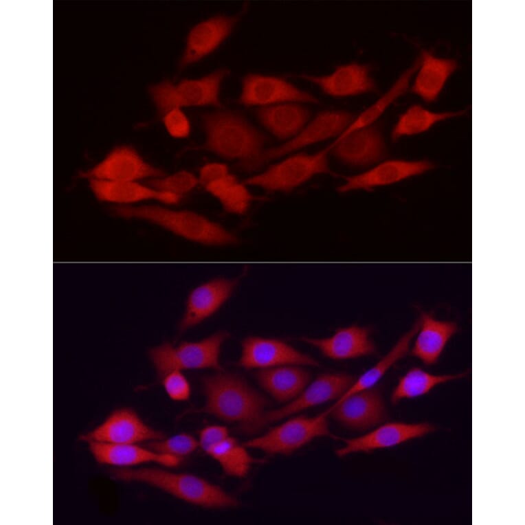 Immunofluorescence - Anti-Ext1 Antibody (A13822) - Antibodies.com