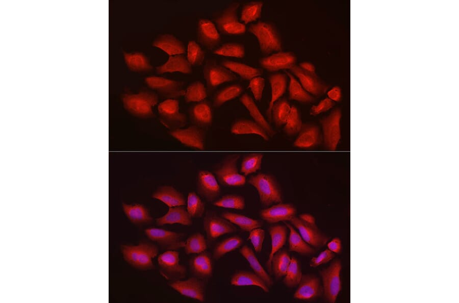 Immunofluorescence - Anti-Ext1 Antibody (A13822) - Antibodies.com