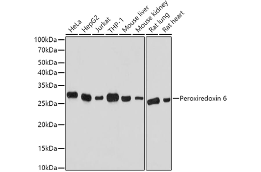 Western Blot - Anti-Peroxiredoxin 6 Antibody (A13823) - Antibodies.com
