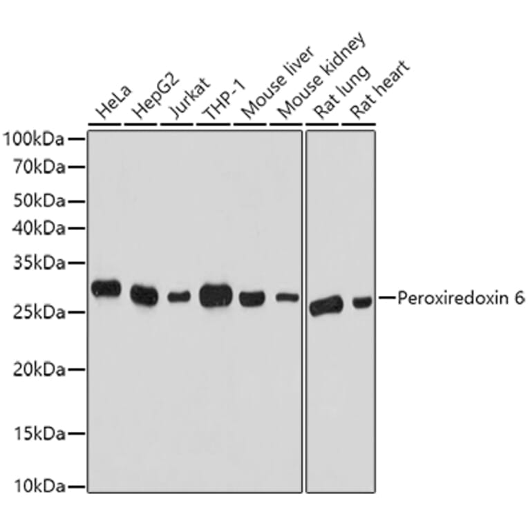 Western Blot - Anti-Peroxiredoxin 6 Antibody (A13823) - Antibodies.com