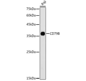 Western Blot - Anti-CD79b Antibody (A13824) - Antibodies.com