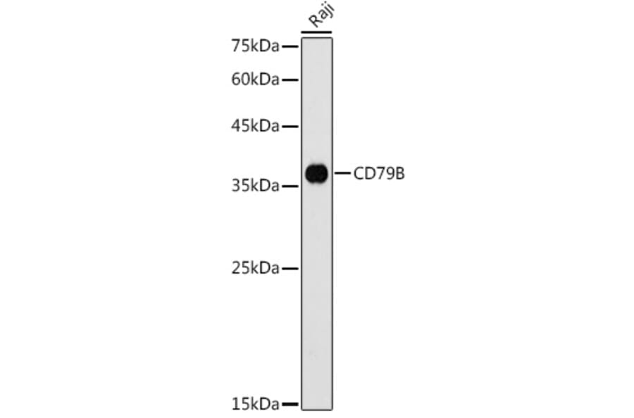 Western Blot - Anti-CD79b Antibody (A13824) - Antibodies.com