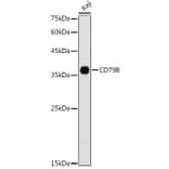 Western Blot - Anti-CD79b Antibody (A13824) - Antibodies.com