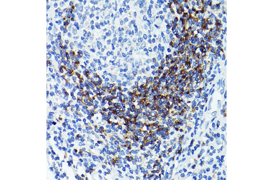 Immunohistochemistry - Anti-CD79b Antibody (A13824) - Antibodies.com