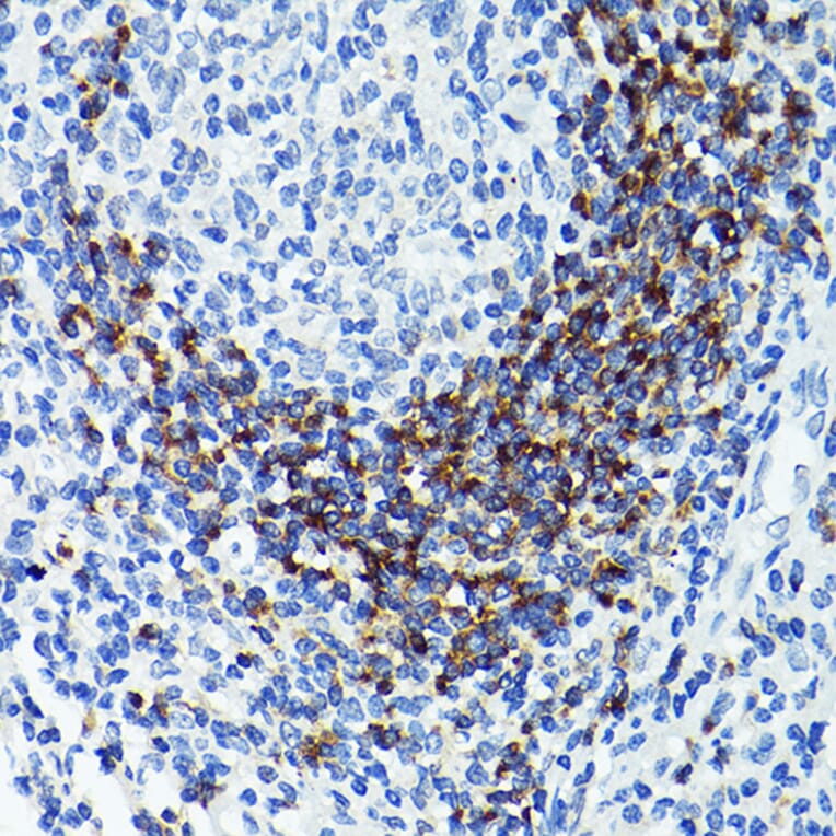 Immunohistochemistry - Anti-CD79b Antibody (A13824) - Antibodies.com