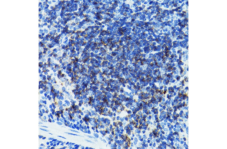 Immunohistochemistry - Anti-CD79b Antibody (A13824) - Antibodies.com