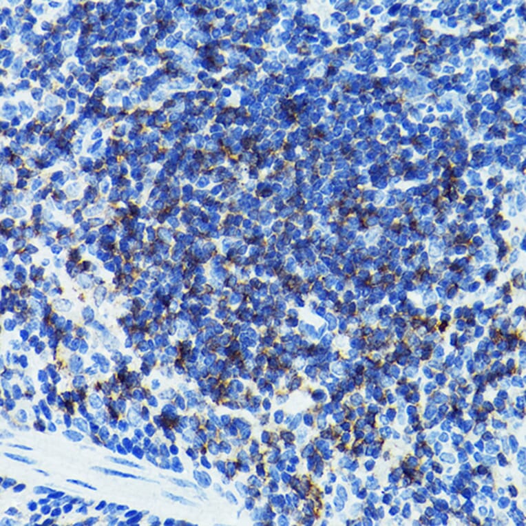 Immunohistochemistry - Anti-CD79b Antibody (A13824) - Antibodies.com