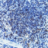 Immunohistochemistry - Anti-CD79b Antibody (A13824) - Antibodies.com