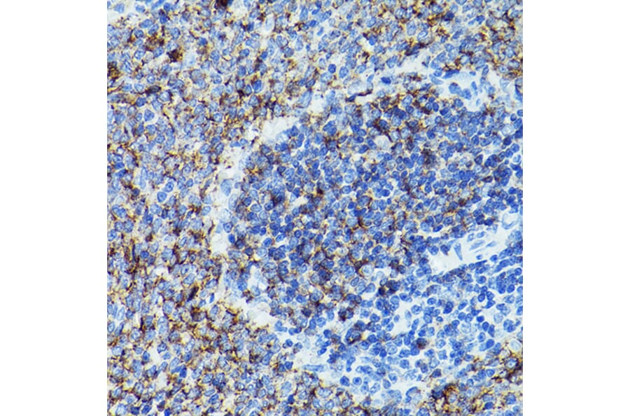 Immunohistochemistry - Anti-CD79b Antibody (A13824) - Antibodies.com