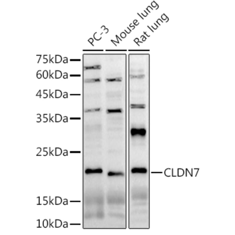 Western Blot - Anti-Claudin 7/CLDN-7 Antibody (A13825) - Antibodies.com