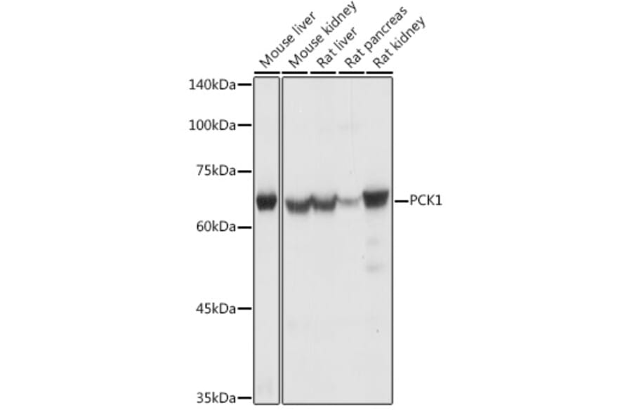 Western Blot - Anti-PCK1/PEPC Antibody (A13826) - Antibodies.com