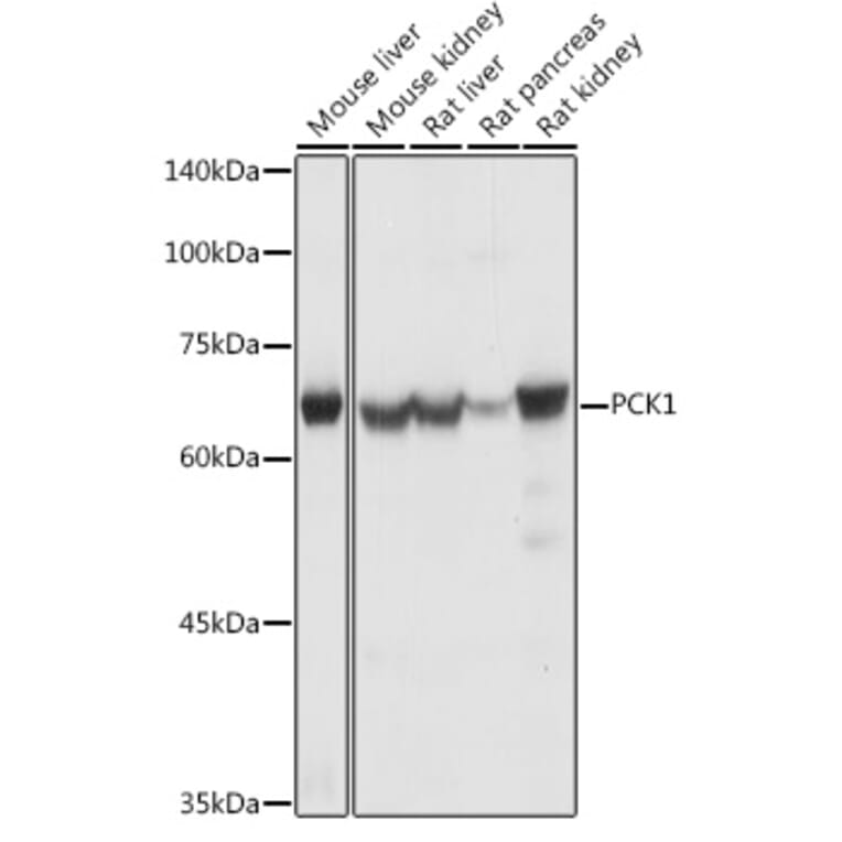 Western Blot - Anti-PCK1/PEPC Antibody (A13826) - Antibodies.com