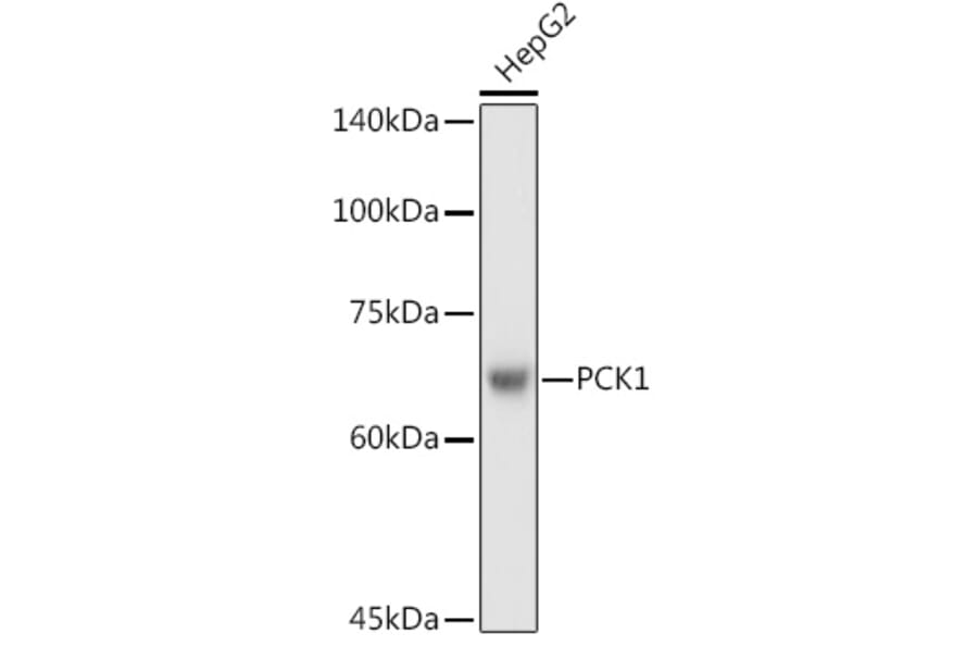 Western Blot - Anti-PCK1/PEPC Antibody (A13826) - Antibodies.com
