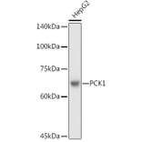 Western Blot - Anti-PCK1/PEPC Antibody (A13826) - Antibodies.com